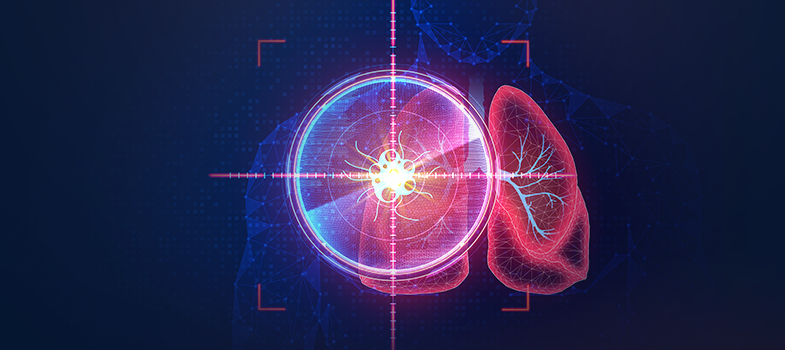 KONTUROWANIE W RAKU PŁUCA 2025