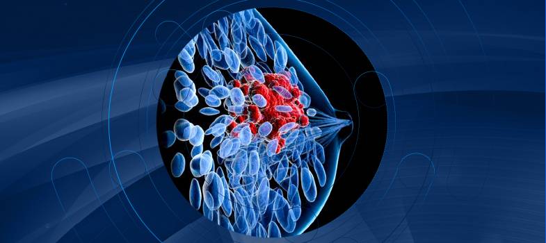 CO 2025 ROK ZMIENIŁ W LECZENIU RAKA PIERSI?